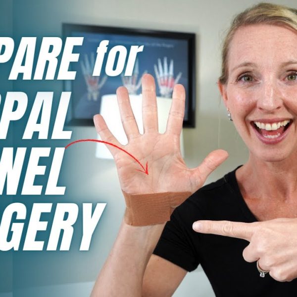 How to Prepare for Carpal Tunnel Surgery: Hand Surgery Tips